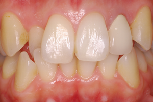 0000002147_%E5%B1%B1%E4%B8%AD%20%E4%BD%B3%E7%B9%94_IntraOral_20090217104233.bmp