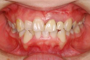 0000002537_%E6%B8%85%E6%B0%B4%20%E7%BE%8E%E7%B4%80_IntraOral_20090122165205.jpg